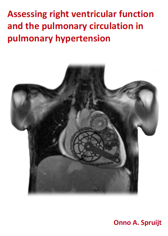 Spruijt - Assessing right ventricular function and the pulmonary circulation in pulmonary hypertension