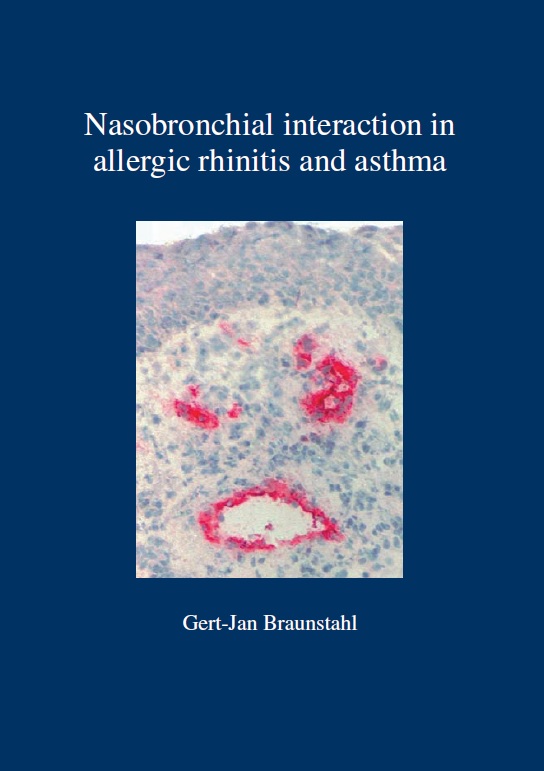 Braunstahl - Nasobronchial interaction in allergic rhinitis and asthma