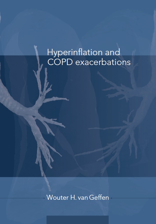 Geffen - Hyperinflation and COPD exacerbations