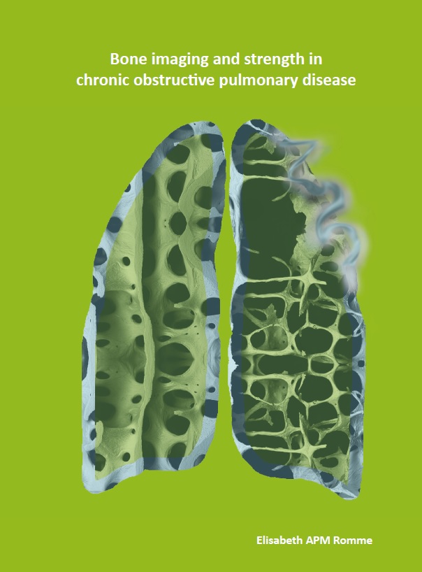 Romme - Bone imaging and strength in chronic obstructive pulmonary disease