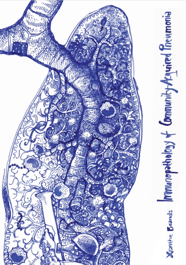 Brands - Immunopathology of Community-Acquired Pneumonia