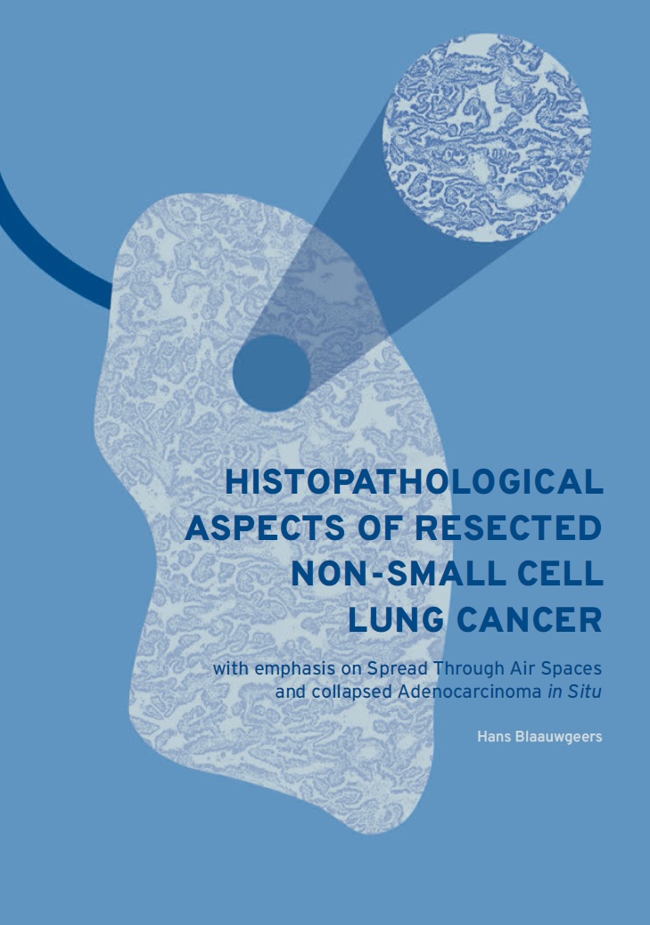 Blaauwgeers - Histopathological aspects of resected non-small cell lung cancer