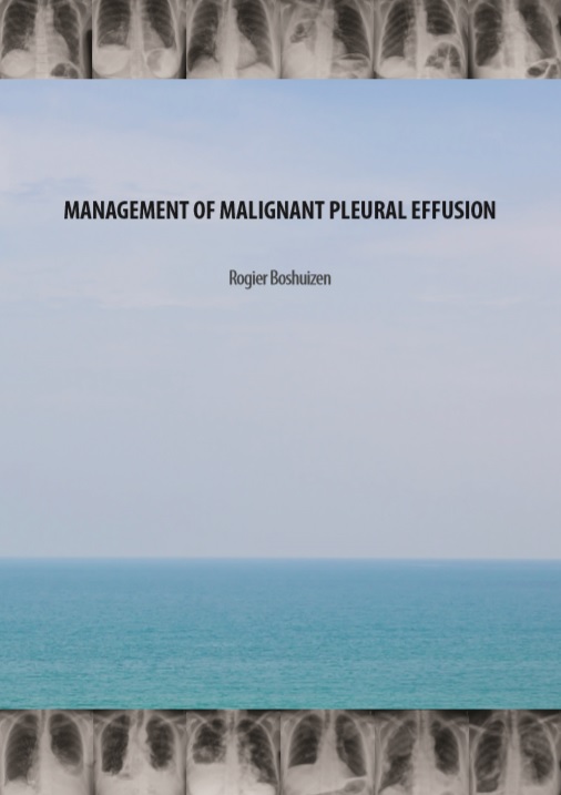 Boshuizen - Management of malignant pleural effusion