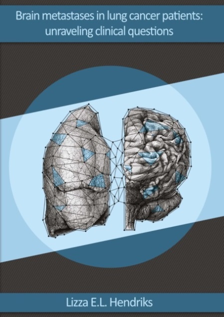 Hendriks - Brain metastases in lung cancer patients