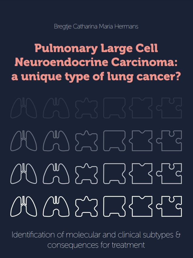 Hermans - Pulmonary Large Cel Neuroendocrine Carcinoma