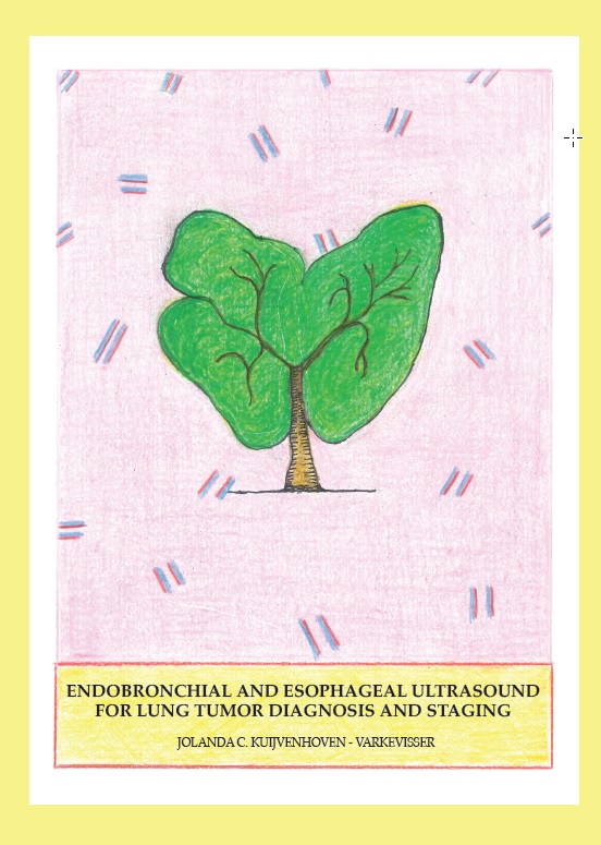 Kuijvenhoven - Endobronchial and esophageal ultrasound for lung tumor diagnosis and staging