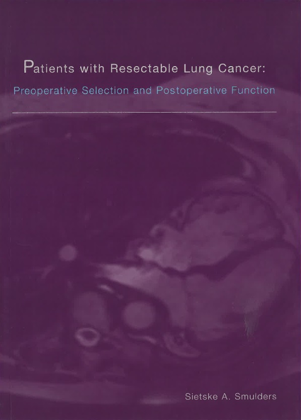 Smulders - Patients with Resectable Lung Cancer  Preoperative selection and postoperative function