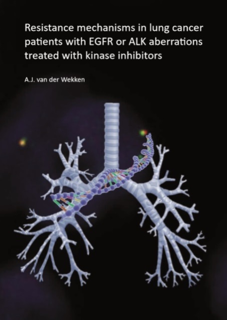 Wekken - Resistance mechanisms in lung cancer patients with EGFR or ALK aberrations treated with kinase inhibitors