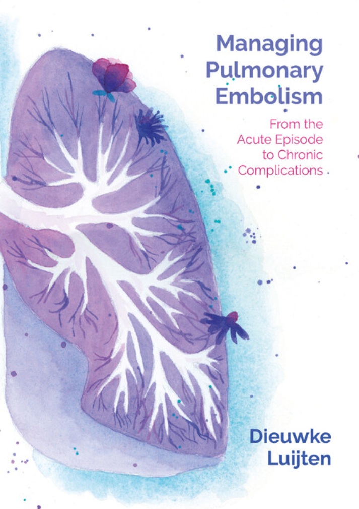 Luijten - Managing Pulmorary Embolism
