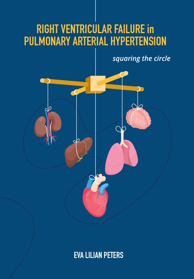 Peters - Right ventricular failure in pulmonary arterial hypertension